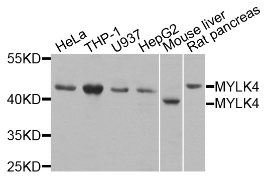 Western blot - MYLK4 Polyclonal Antibody 