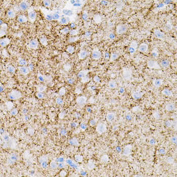Immunohistochemistry - NTF3 Polyclonal Antibody 