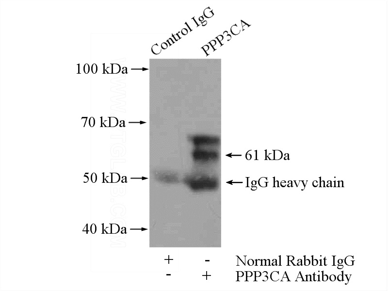 IP Result of anti-PPP3CA (IP:Catalog No:114108, 4ug; Detection:Catalog No:114108 1:1000) with mouse heart tissue lysate 4400ug.