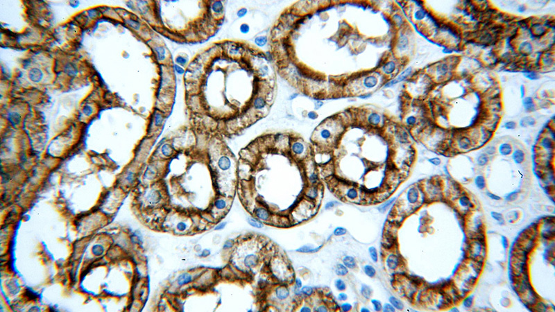 Immunohistochemical of paraffin-embedded human kidney using Catalog No:108045(AQP1 antibody) at dilution of 1:100 (under 40x lens)