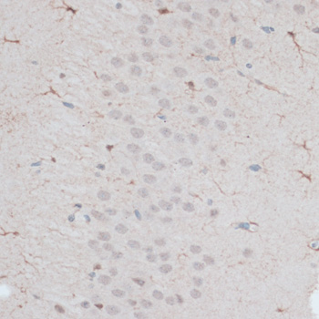 Immunohistochemistry - ZNF415 Polyclonal Antibody 