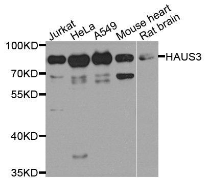 Western blot - HAUS3 Polyclonal Antibody 