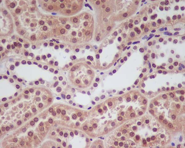 Immunohistochemical analysis of paraffin-embedded human kindey, using HIF-1 alpha Antibody.
