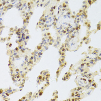 Immunohistochemistry - HDGF Polyclonal Antibody 