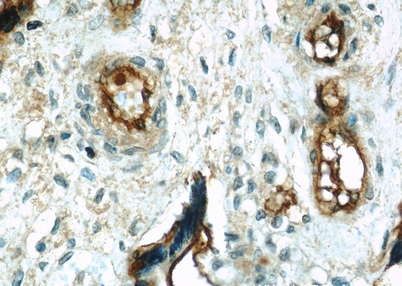 Immunohistochemical of paraffin-embedded human placenta using Catalog No:109034(ENTPD1 antibody) at dilution of 1:50 (under 40x lens)