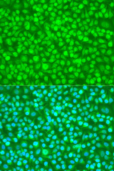 Immunofluorescence - N4BP1 Polyclonal Antibody 