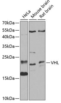 Western blot - VHL Polyclonal Antibody 