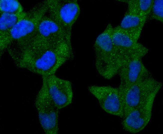 Fig4: ICC staining ABCF1 in Hela cells (green). The nuclear counter stain is DAPI (blue). Cells were fixed in paraformaldehyde, permeabilised with 0.25% Triton X100/PBS.