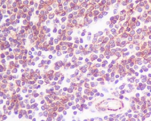 Immunohistochemical analysis of paraffin-embedded human spleen, using CCR7 Antibody.