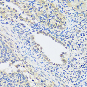 Immunohistochemistry - C12orf10 Polyclonal Antibody 