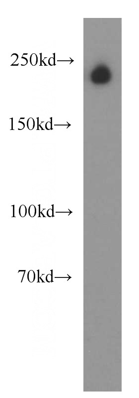 human brain tissue were subjected to SDS PAGE followed by western blot with Catalog No:116572(UNC13A antibody) at dilution of 1:300