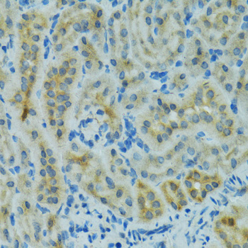 Immunohistochemistry - CYP2B6 Polyclonal Antibody 