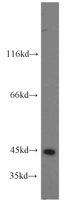 HEK-293 cells were subjected to SDS PAGE followed by western blot with Catalog No:114293(PSAT1 antibody) at dilution of 1:500