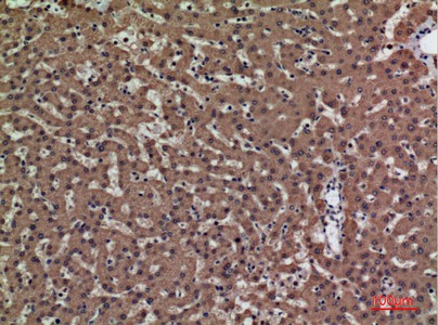 Fig2:; Immunohistochemical analysis of paraffin-embedded human-liver, antibody was diluted at 1:100