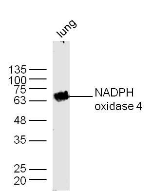 Fig5: Sample: Lung (Mouse) Lysate at 40 ug; Primary: Anti- NADPH oxidase4 at 1/300 dilution; Secondary: IRDye800CW Goat Anti-Rabbit IgG at 1/20000 dilution; Predicted band size: 64 kD; Observed band size: 64 kD