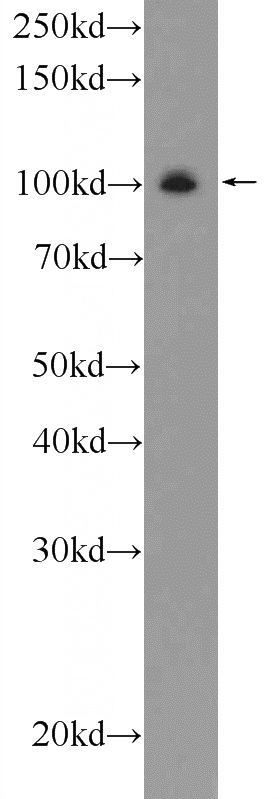 rat brain tissue were subjected to SDS PAGE followed by western blot with Catalog No:111205(GRIA4 Antibody) at dilution of 1:600