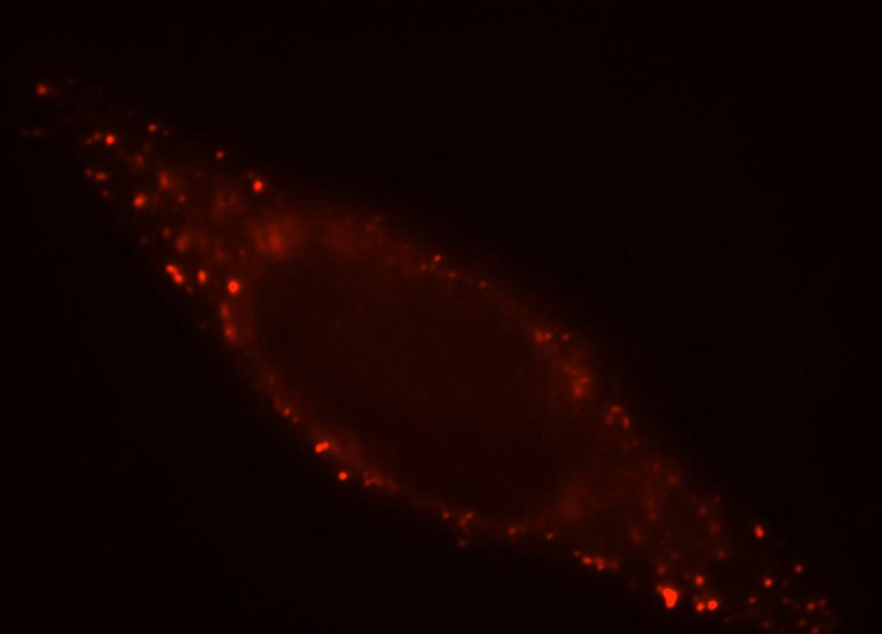 Immunofluorescent analysis of HepG2 cells, using CKM antibody Catalog No:109542 at 1:25 dilution and Rhodamine-labeled goat anti-rabbit IgG (red).