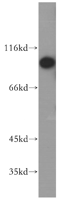 HeLa cells were subjected to SDS PAGE followed by western blot with Catalog No:112247(SLC39A6 antibody) at dilution of 1:1000