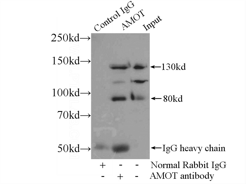 IP Result of anti-AMOT (IP:Catalog No:107998, 4ug; Detection:Catalog No:107998 1:300) with HEK-293 cells lysate 2500ug.