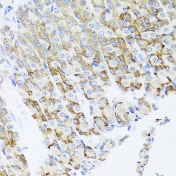 Immunohistochemistry - PIK3CA Polyclonal Antibody 