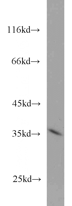 A431 cells were subjected to SDS PAGE followed by western blot with Catalog No:115703(STEAP1 antibody) at dilution of 1:500