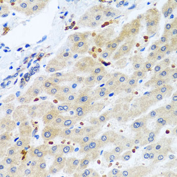 Immunohistochemistry - RGS5 Polyclonal Antibody 