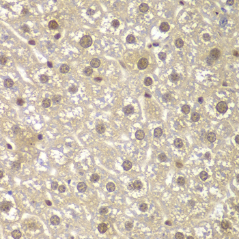 Immunohistochemistry - MAD1L1 Polyclonal Antibody 