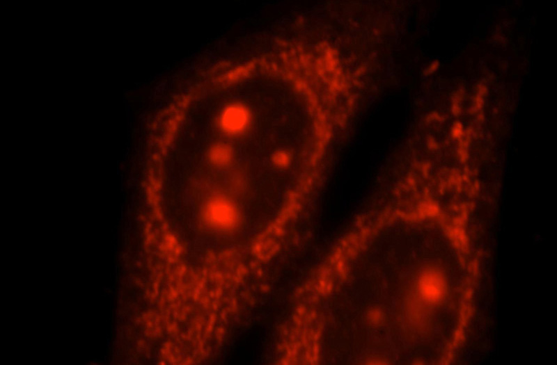 Immunofluorescent analysis of HepG2 cells, using RPS21 antibody Catalog No:114834 at 1:25 dilution and Rhodamine-labeled goat anti-rabbit IgG (red).