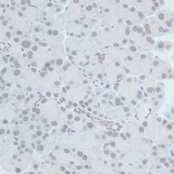 Immunohistochemistry - ZNF703 Polyclonal Antibody 