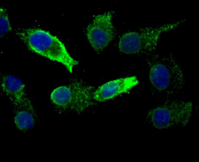 Fig2:; ICC staining of KDEL in A549 cells (green). Formalin fixed cells were permeabilized with 0.1% Triton X-100 in TBS for 10 minutes at room temperature and blocked with 1% Blocker BSA for 15 minutes at room temperature. Cells were probed with the primary antibody ( 1/500) for 1 hour at room temperature, washed with PBS. Alexa Fluor®488 Goat anti-Rabbit IgG was used as the secondary antibody at 1/1,000 dilution. The nuclear counter stain is DAPI (blue).