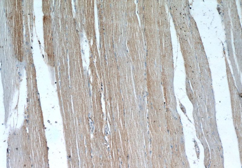 Immunohistochemistry of paraffin-embedded human skeletal muscle slide using Catalog No:108760(CACNA1S Antibody) at dilution of 1:50 (under 10x lens)