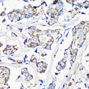Immunohistochemistry - MMP16 Polyclonal Antibody 