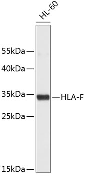 Western blot - HLA-F Polyclonal Antibody 