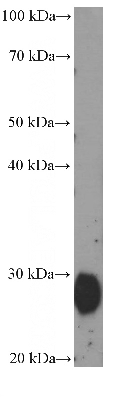human adipose tissue were subjected to SDS PAGE followed by western blot with Catalog No:107559(ADIPOQ Antibody) at dilution of 1:1000