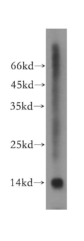 mouse testis tissue were subjected to SDS PAGE followed by western blot with Catalog No:116190(TMEM50B antibody) at dilution of 1:200