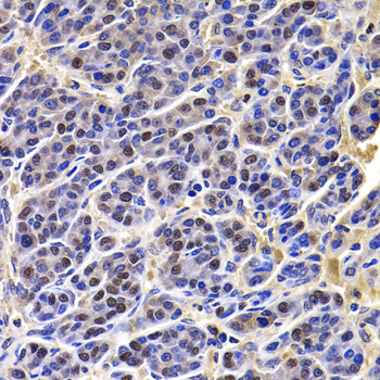 Immunohistochemistry - HIRIP3 Polyclonal Antibody 