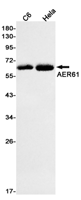 Western blot detection of AER61 in C6,Hela cell lysates using AER61 Rabbit mAb(1:1000 diluted).Predicted band size:62kDa.Observed band size:62kDa.