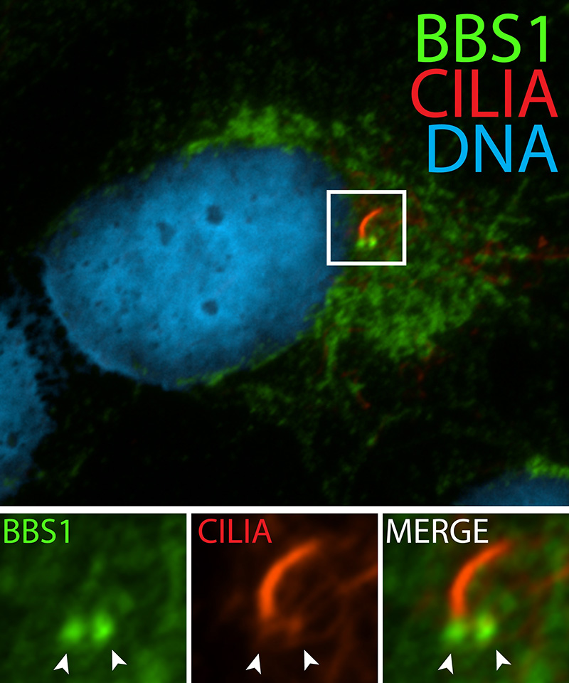 IF result (base of ciliary stain) of anti-BBS1 (Catalog No:108367, 1:50) with with serum-starved hTERT-RPE1 cells by Dr. Moshe Kim.