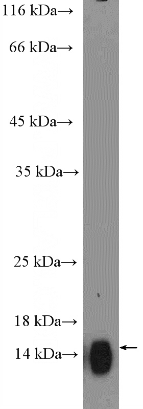 human saliva tissue were subjected to SDS PAGE followed by western blot with Catalog No:109612(CST2-Specific Antibody) at dilution of 1:600