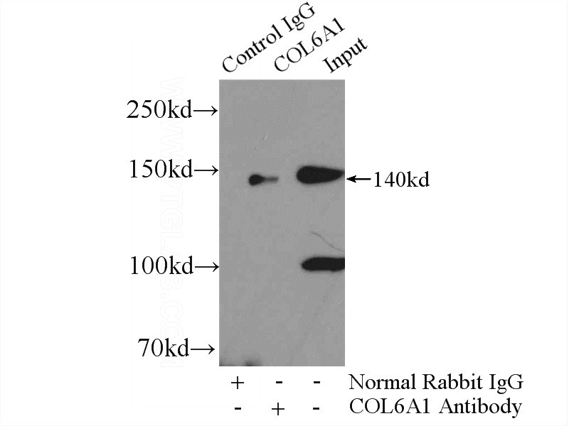 IP Result of anti-COL6A1 (IP:Catalog No:109438, 4ug; Detection:Catalog No:109438 1:500) with mouse heart tissue lysate 8000ug.