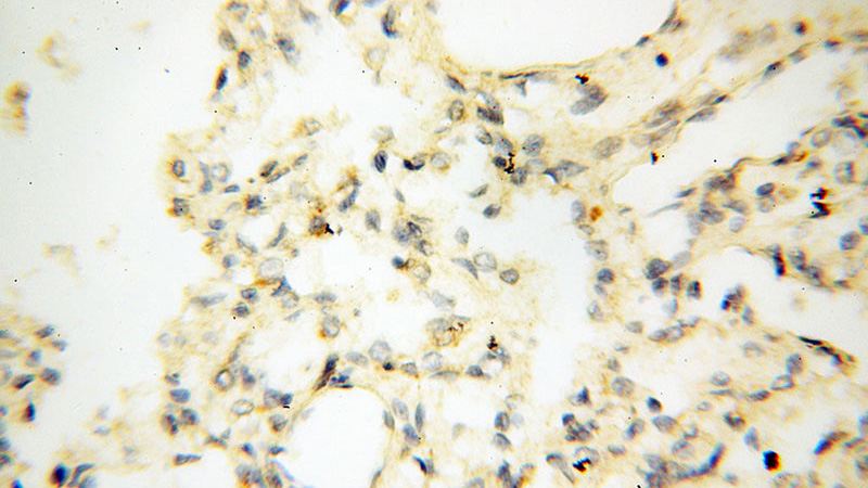 Immunohistochemical of paraffin-embedded human lung using Catalog No:112278(LAMP3 antibody) at dilution of 1:50 (under 40x lens)
