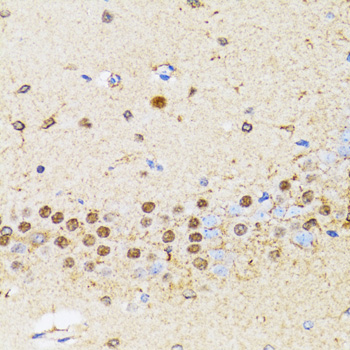 Immunohistochemistry - CHAF1B Polyclonal Antibody 