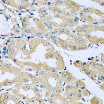 Immunohistochemistry - HS1BP3 Polyclonal Antibody 