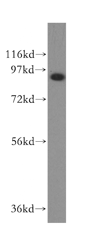 HepG2 cells were subjected to SDS PAGE followed by western blot with Catalog No:110665(BFSP1 antibody) at dilution of 1:500