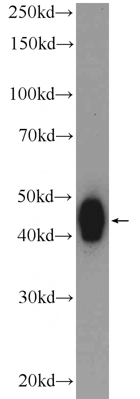 HEK-293 cells were subjected to SDS PAGE followed by western blot with Catalog No:108386(BCKDHB Antibody) at dilution of 1:600