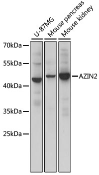 Western blot - AZIN2 Polyclonal Antibody 