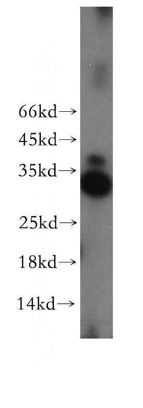 Jurkat cells were subjected to SDS PAGE followed by western blot with Catalog No:108388(BCL10 antibody) at dilution of 1:300