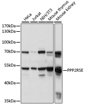 Western blot - PPP2R5E Polyclonal Antibody 