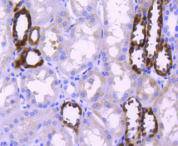 Fig5:; Immunohistochemical analysis of paraffin-embedded human kidney tissue using anti-PPP1R1A antibody. The section was pre-treated using heat mediated antigen retrieval with Tris-EDTA buffer (pH 9.0) for 20 minutes.The tissues were blocked in 1% BSA for 30 minutes at room temperature, washed with ddH; 2; O and PBS, and then probed with the primary antibody ( 1/50) for 30 minutes at room temperature. The detection was performed using an HRP conjugated compact polymer system. DAB was used as the chromogen. Tissues were counterstained with hematoxylin and mounted with DPX.