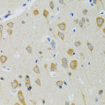 Immunohistochemistry - NEU1 Polyclonal Antibody 